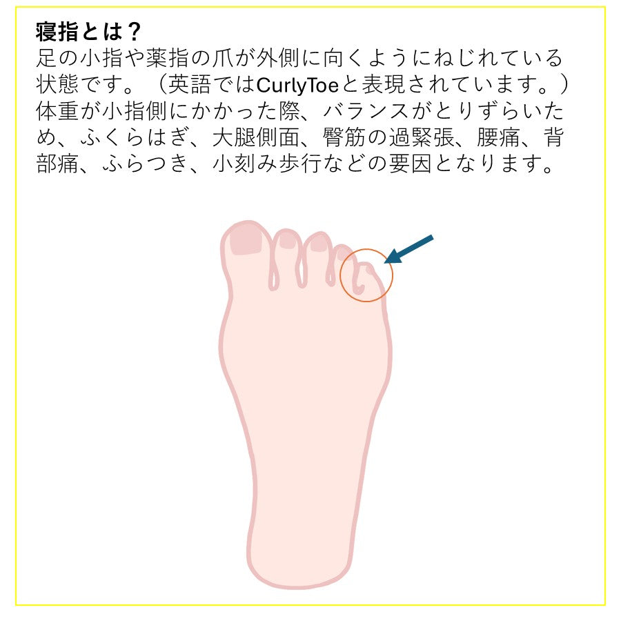 New-HALE パルキュアソロジー 寝指テープ 1.8cm×5m
